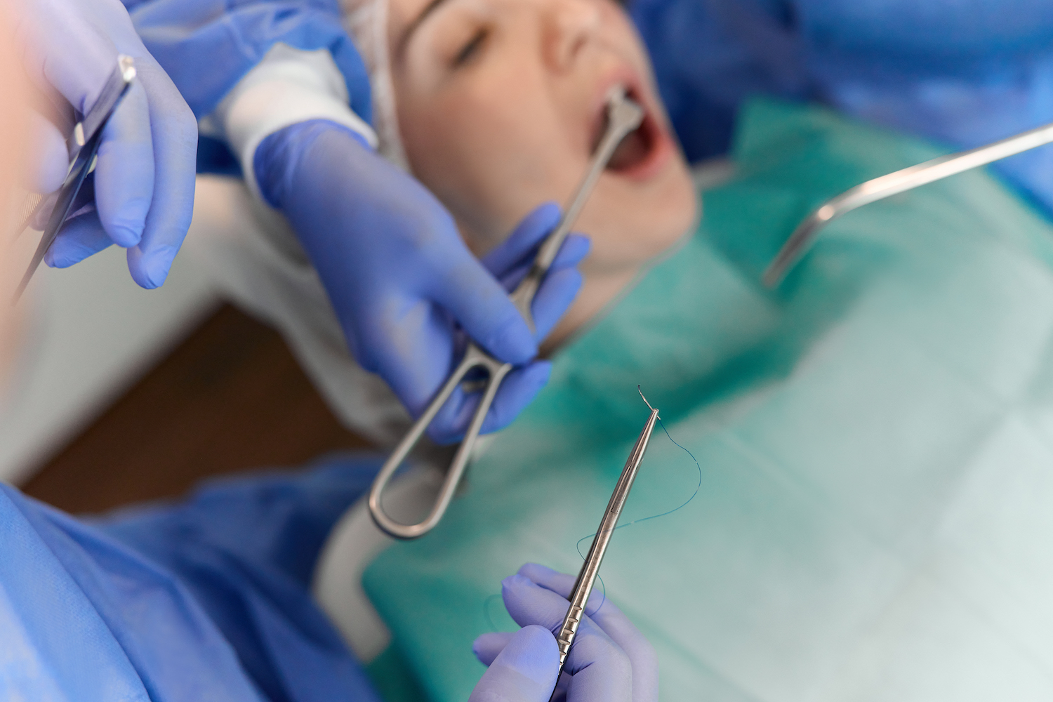 Oralchirurgie & Implantologie - Zahnärzte neXtto Bellevue