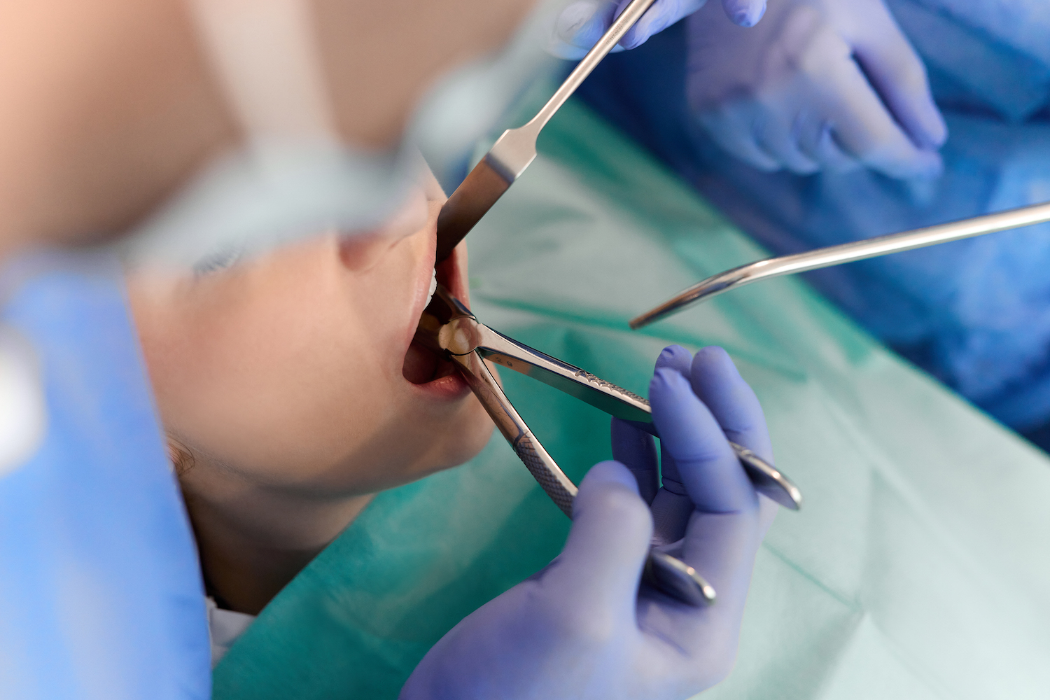 Oralchirurgie & Implantologie - Zahnärzte neXtto Bellevue